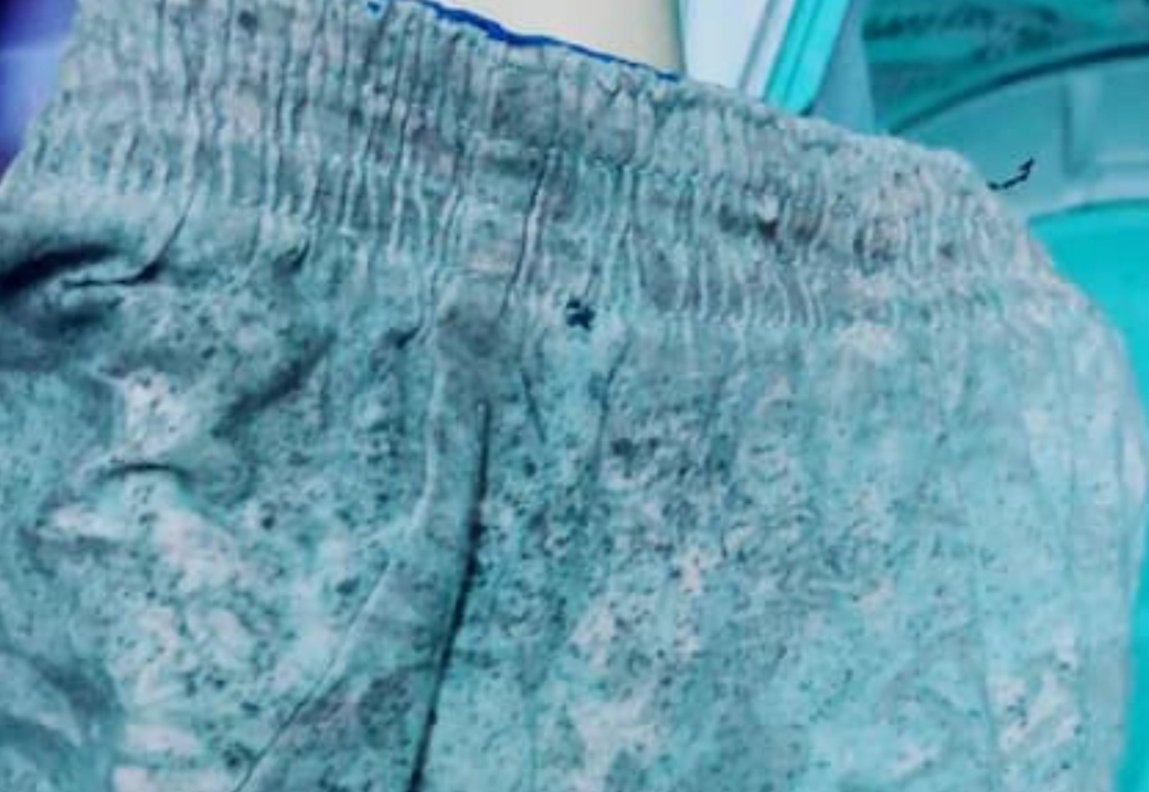 內褲發霉 內褲發霉