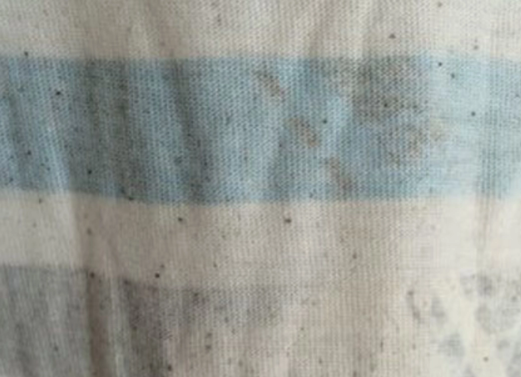 衣服霉斑去除 衣服霉斑去除