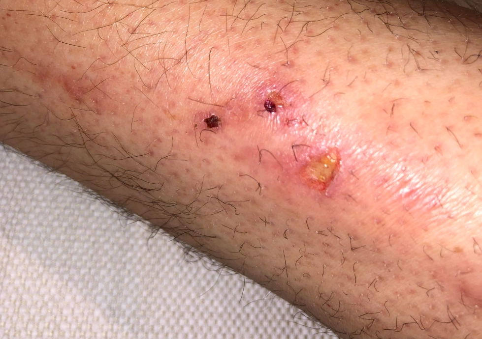 紅蛇夢境解析 紅蛇夢境解析