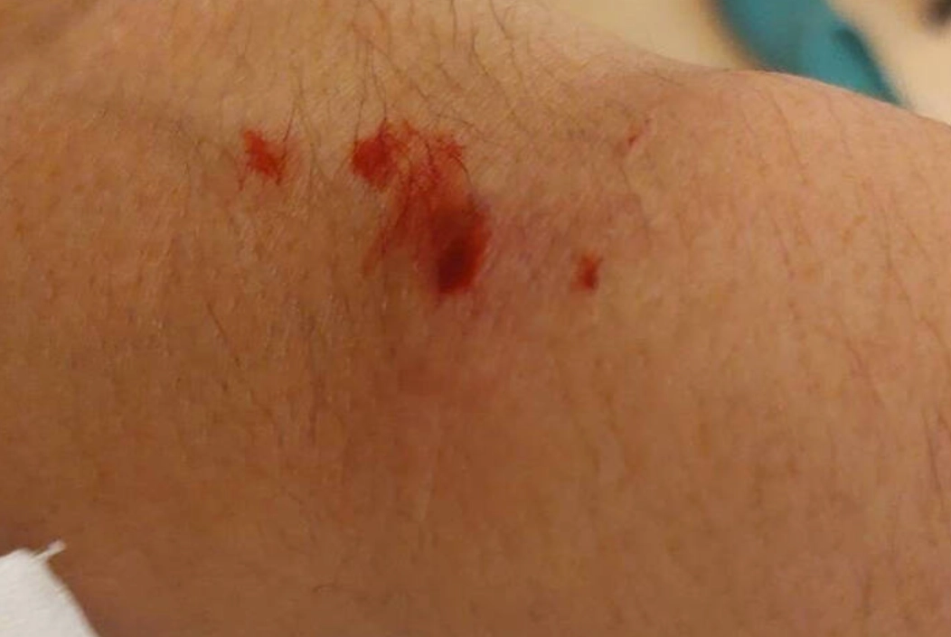 夢到紅蛇咬手 夢到紅蛇咬手