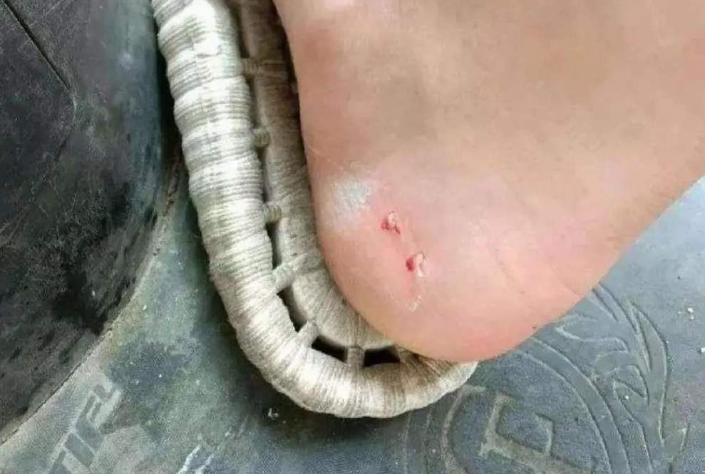 夢見被蛇咬腳 心理學 夢見被蛇咬腳 心理學