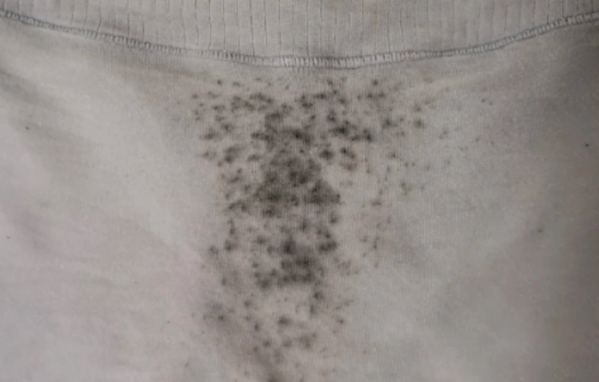 內褲變黑原因 內褲變黑原因