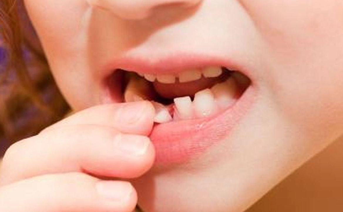 夢見掉牙齒 夢見掉牙齒